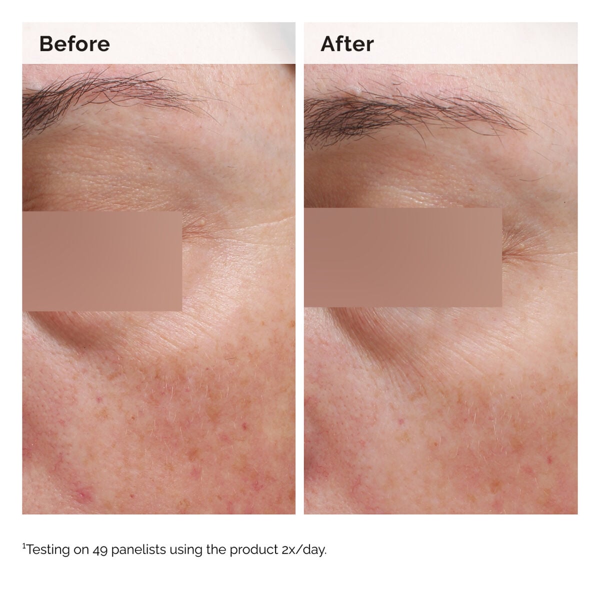 niacinamide-5-face-and-body-emulsion-z6 2024-08-23-ORD-Nia-5pct-Face-Body-B-A-Elasticity-Global-02-1x1.jpg