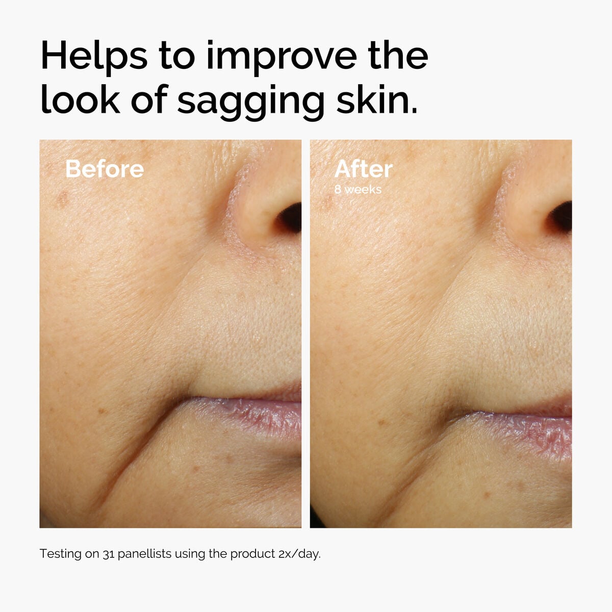 caffeine-3-escin-1-face-serum-a6 ord-caffeine-3pct-escin-1pct-face-serum-before-after-sagging.jpg