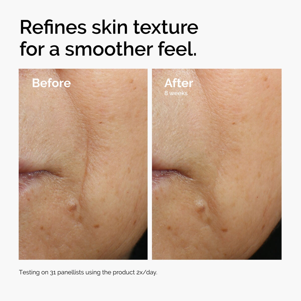 caffeine-3-escin-1-face-serum-a6 ord-caffeine-3pct-escin-1pct-face-serum-before-after-texture.jpg
