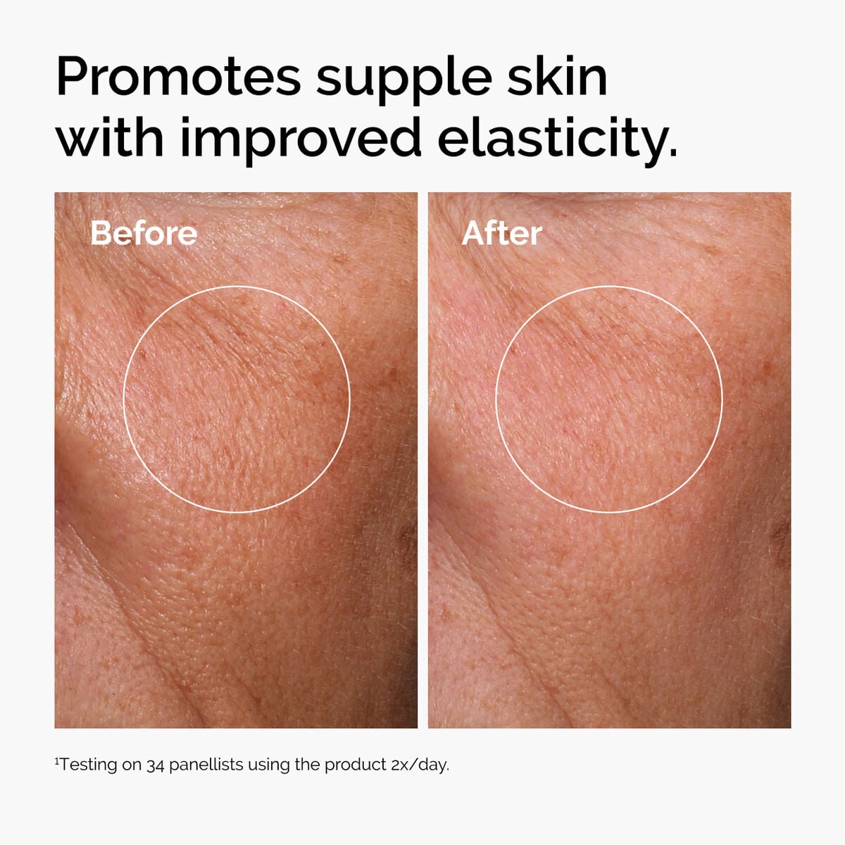 hyaluronic-acid-2-b5-with-ceramides-l7 ord-hyaluronic-acid-2pct-b5-hydrating-serum-before-after-elasticity.jpg