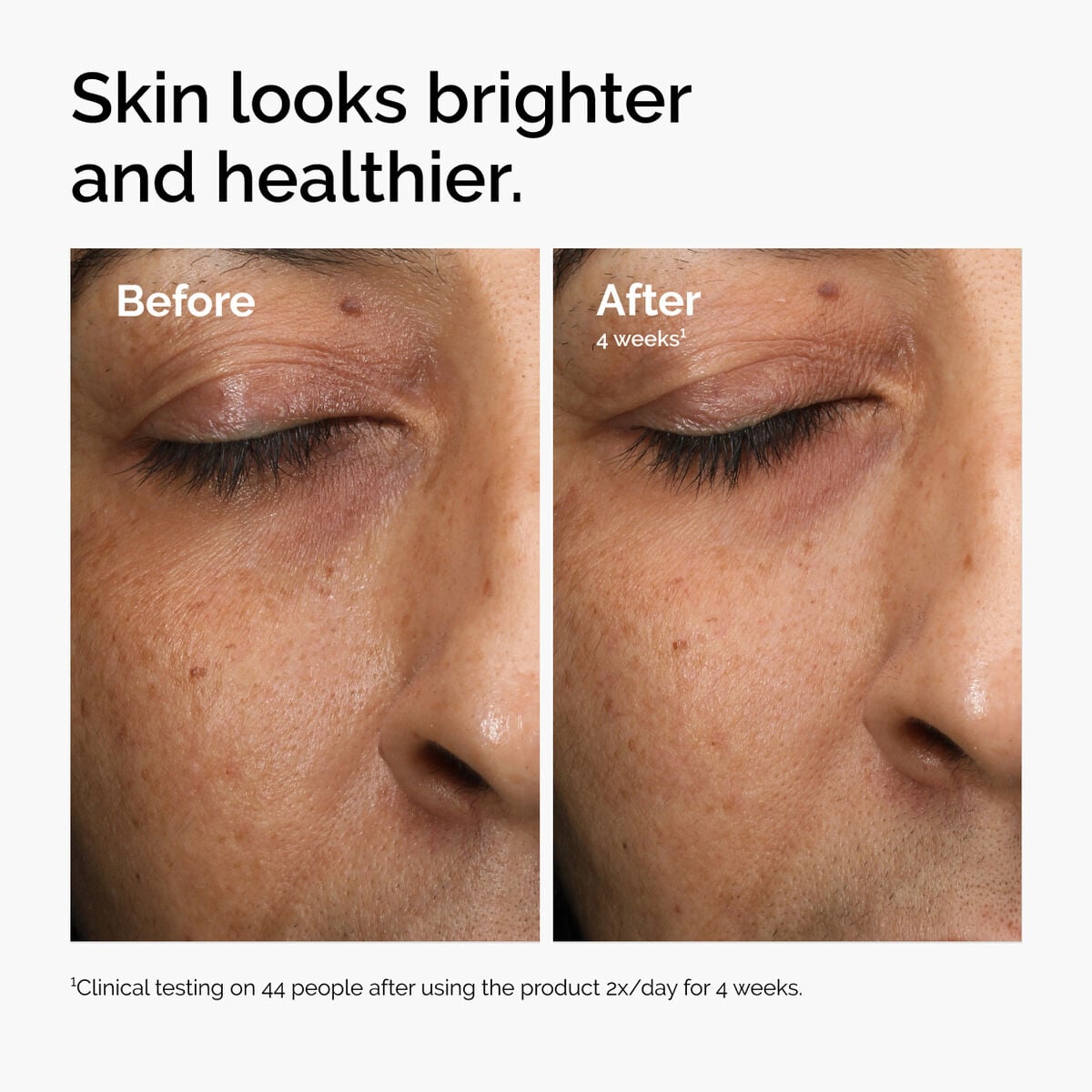 multi-antioxidant-radiance-serum-m4 ord-mars-before-after-healthy.jpg