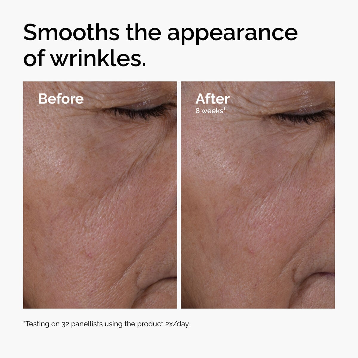 multi-peptide-ha-serum-y4 ord-multi-peptide-ha-serum-wrinkles-before-after.jpg