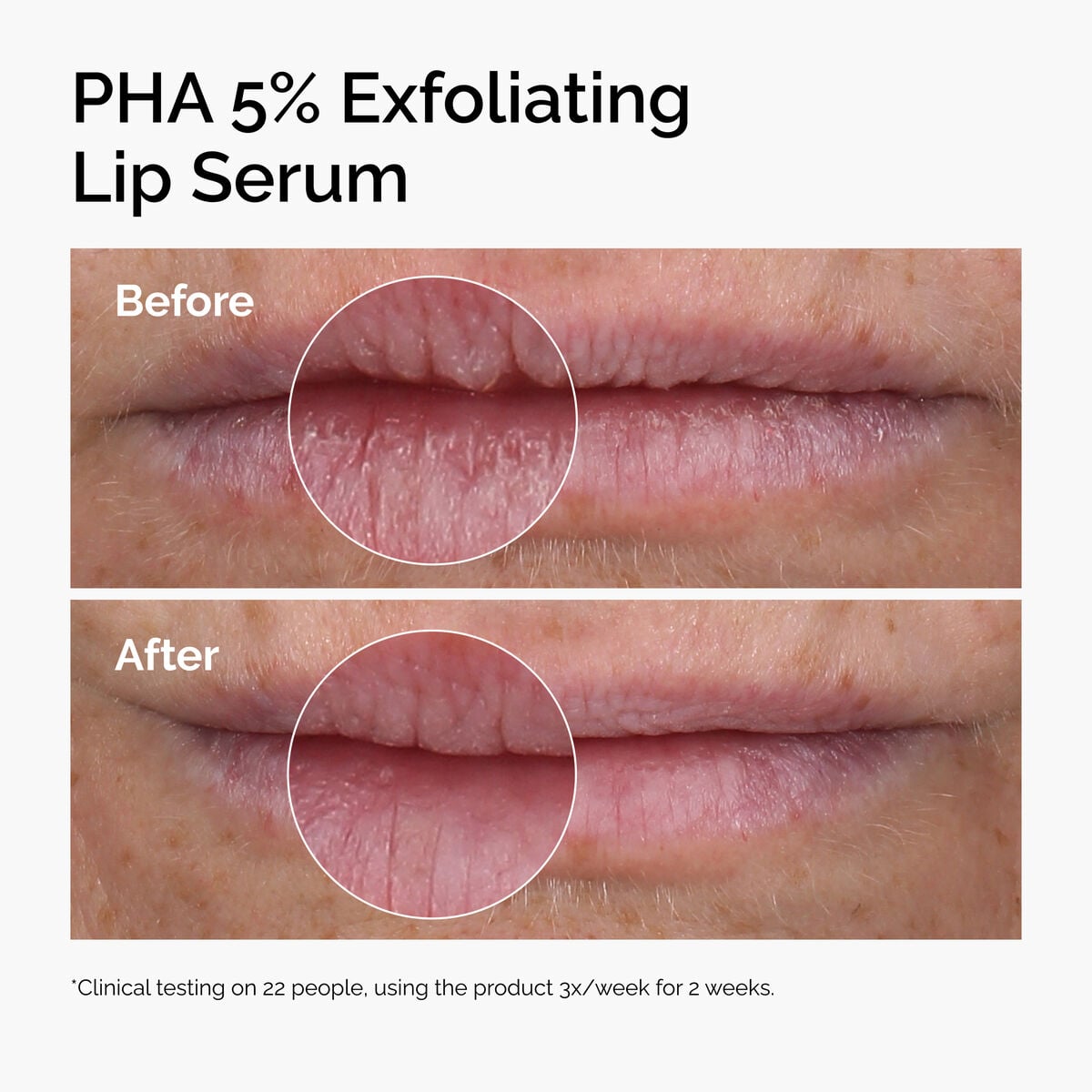 pha-5-exfoliating-lip-serum-g6 ord-pha-5pct-lip-exfoliating-serum-before-after.jpg